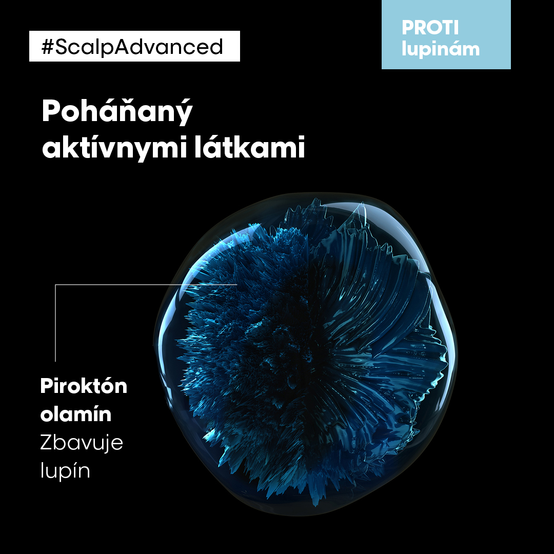 Akt&iacute;vne l&aacute;tky proti lupin&aacute;m vo vlasoch