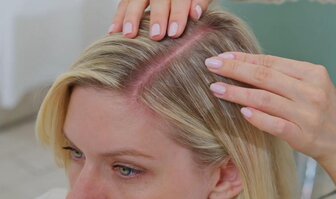 Suchá pokožka hlavy - hlavné príčiny a účinné riešenia