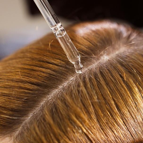 Aplik&aacute;cia vlasov&eacute; s&eacute;ra na such&uacute; kožu na hlave