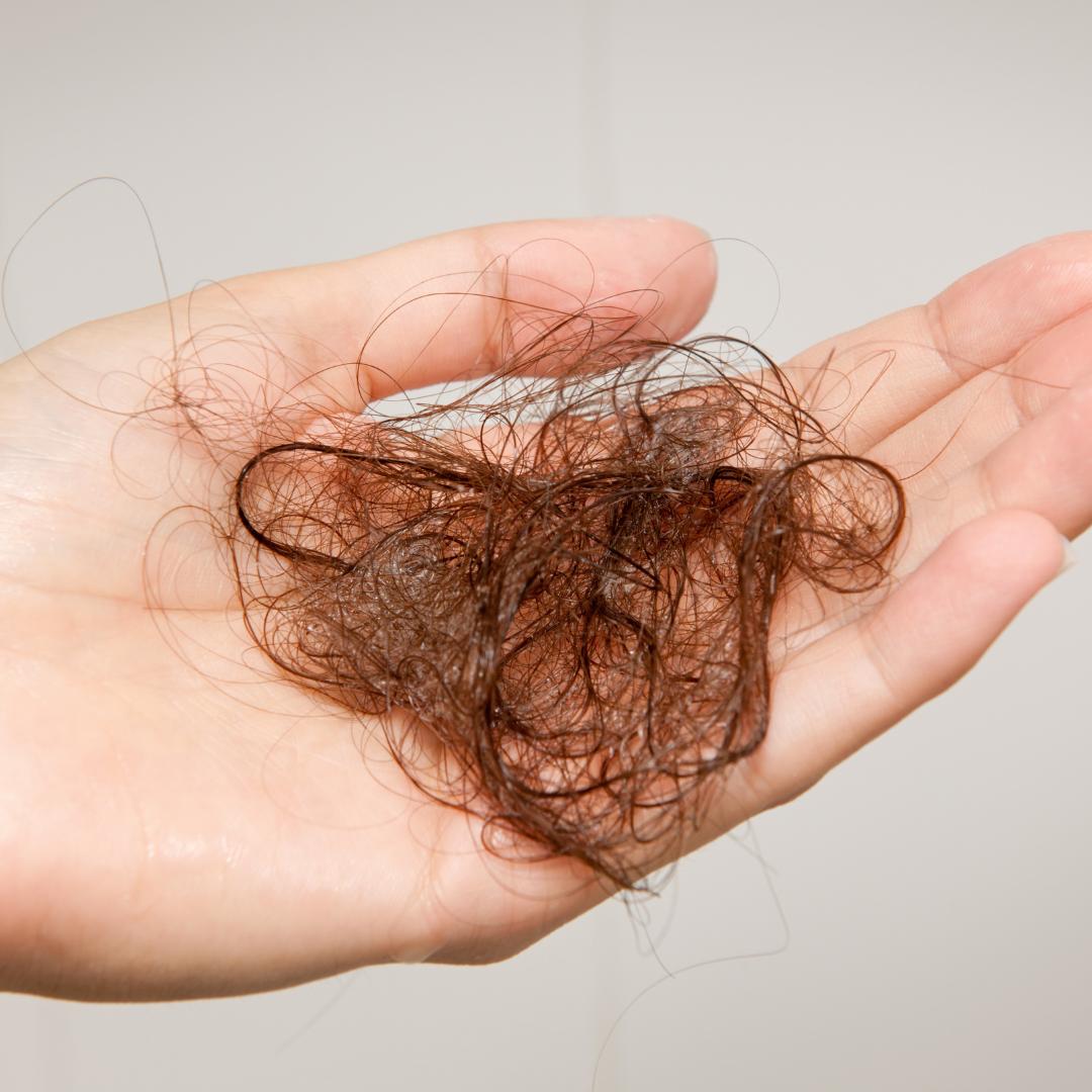 Vypadávanie vlasov ženy